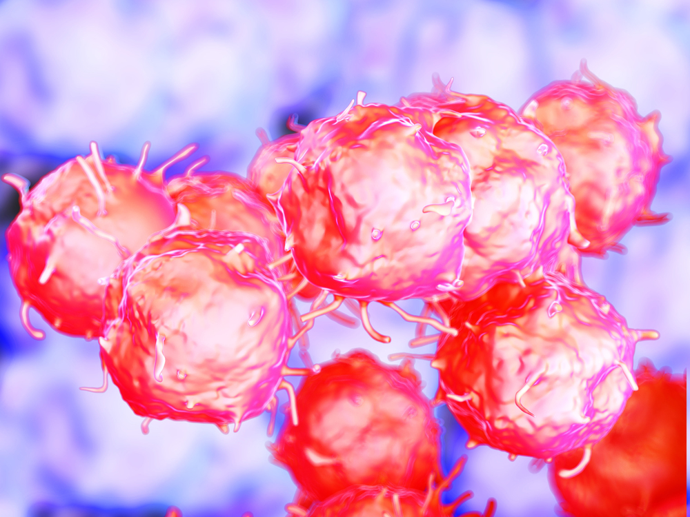 3-D Organoid for non-Hodgkin Lymphoma Expected to Greatly Aid in New Treatments