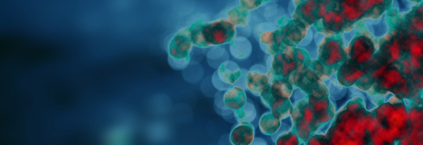 Lymphoma Development Linked in Study to Mutations in Gene Regulating Plasma Cells