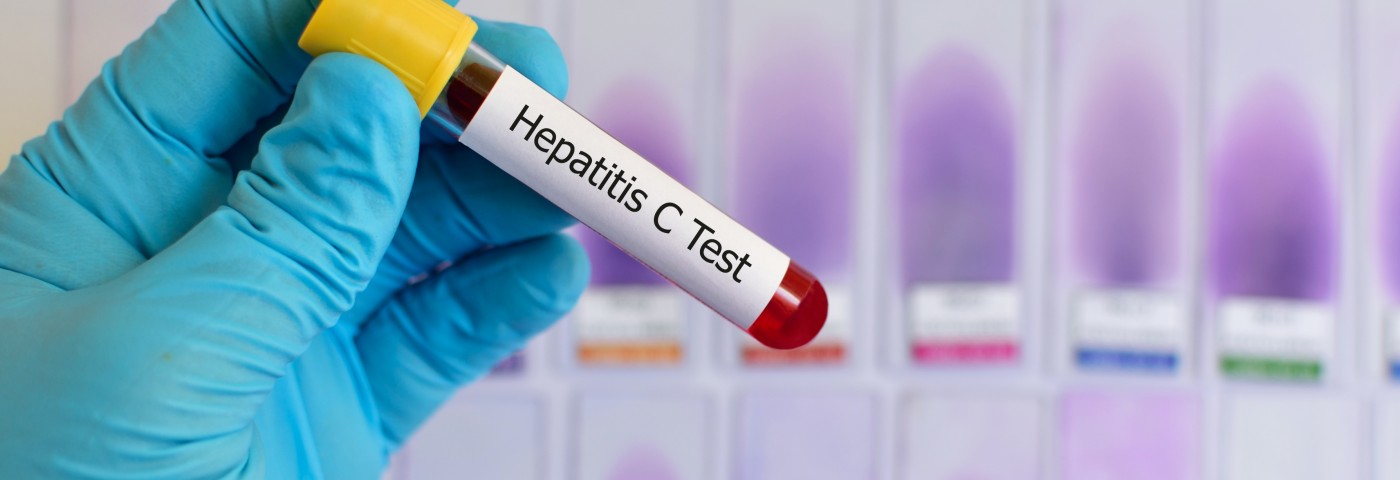 Researchers Link Hepatitis C Virus to Head and Neck Cancers