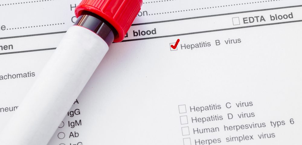 Hepatitis B- and C-Positive Patients Seem to Carry Higher Risks for Non-Hodgkin’s Lymphoma, According to Study
