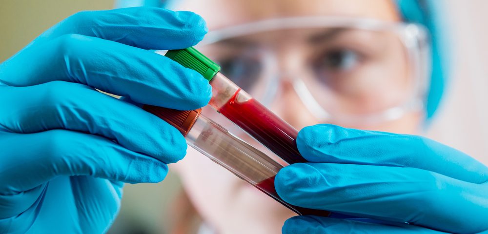 Clevecord, Umbilical Cord Blood Product for HSCT in Lymphoma Patients, Approved by FDA