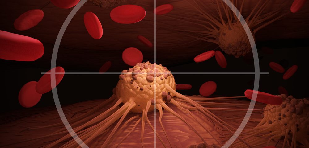 UNC Lineberger Cancer Center Launches Lymphoma Trials with CAR T-cells