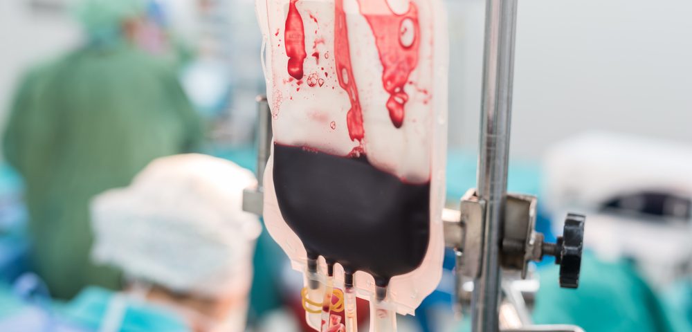 Side Effects of Bone Marrow Transplant Reduced by Expanding Regulatory T-Cells in Mouse Study