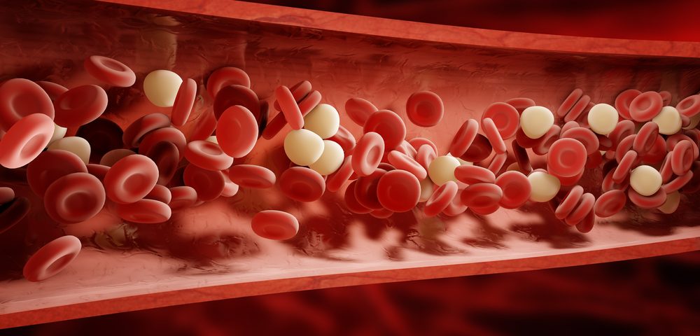 Blood Biomarkers Can Predict Survival of Patients with Diffuse Large B-Cell Lymphoma