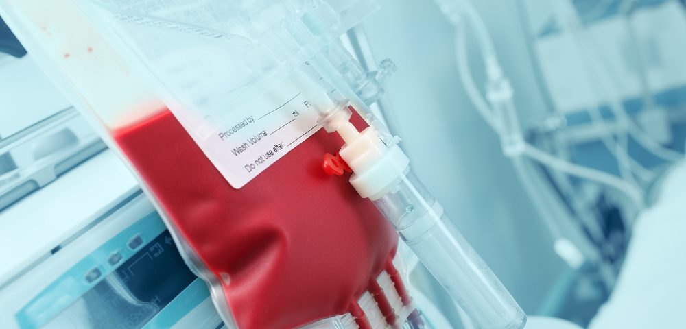 21st Century Blood Transfusions Associated with Higher Risk of Non-Hodgkin’s Lymphoma, Liver Cancer