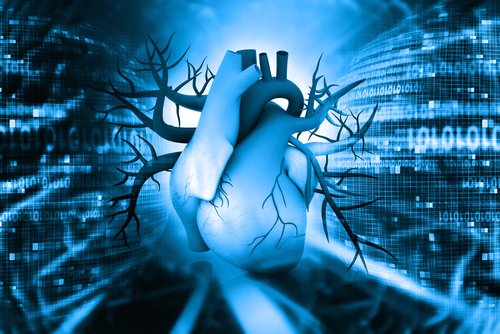 Chest Radiation Therapy Increases Risk of Severe Coronary Artery Disease in Hodgkin Lymphoma Patients