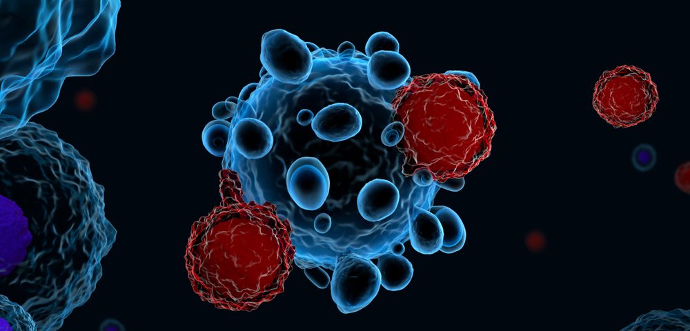 Juno, Celgene Report Impressive Results of CAR T-cell Therapy in B-cell Lymphoma