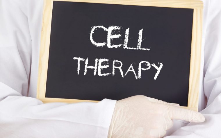 CAR T-cell therapy and KTE-X19